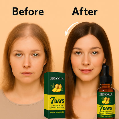 ZENORIA 7-dnevni ingverjev serum za rast in obnovo las 